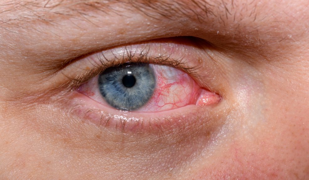 ¿Por qué tiembla el párpado del ojo y qué enfermedades podría padecer? Un Síntoma Común con Posibles Implicaciones Serias