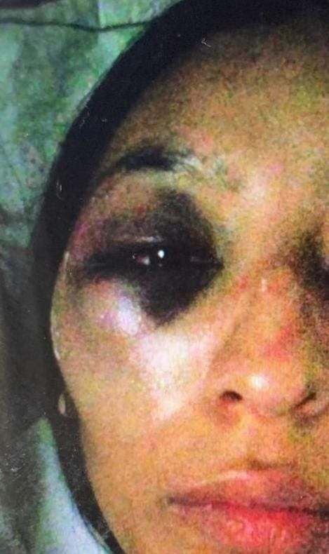 Mujer denuncia brutal agresión de conductor en el sur de Bogotá Un indignante caso de violencia y hurto a una mujer ocurrió el pasado 1 de junio al interior de un vehículo de servicio público. La víctima denuncia que el conductor del automotor la agredió física y sexualmente.