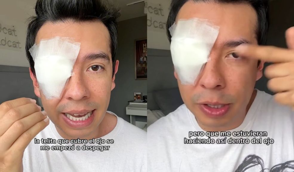 Ami Rodríguez sufrió grave accidente en un ojo ¿Qué le pasó? El creador de contenido bogotano Ami Rodríguez sorprendió a sus seguidores al aparecer con un parche en uno de sus ojos. En un video, el influencer explicó que sufrió un accidente que lo llevó a acudir de urgencia al hospital debido a una fuerte molestia ocular.